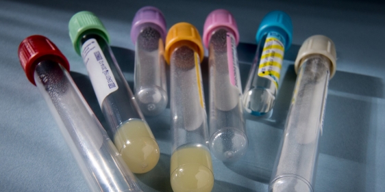 20140708_medical_008_large