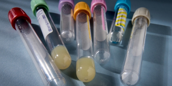 20140708_medical_008_large_1