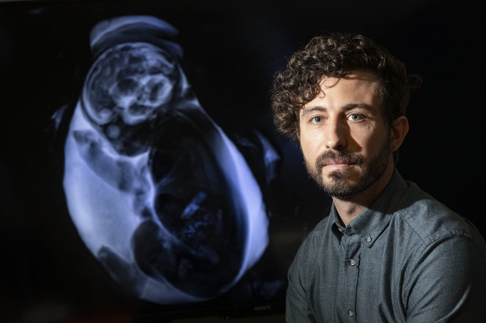 Vlad Ayzenberg next to a baby scan