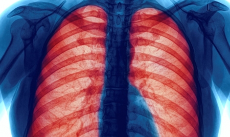 istock_000043649442_double_large