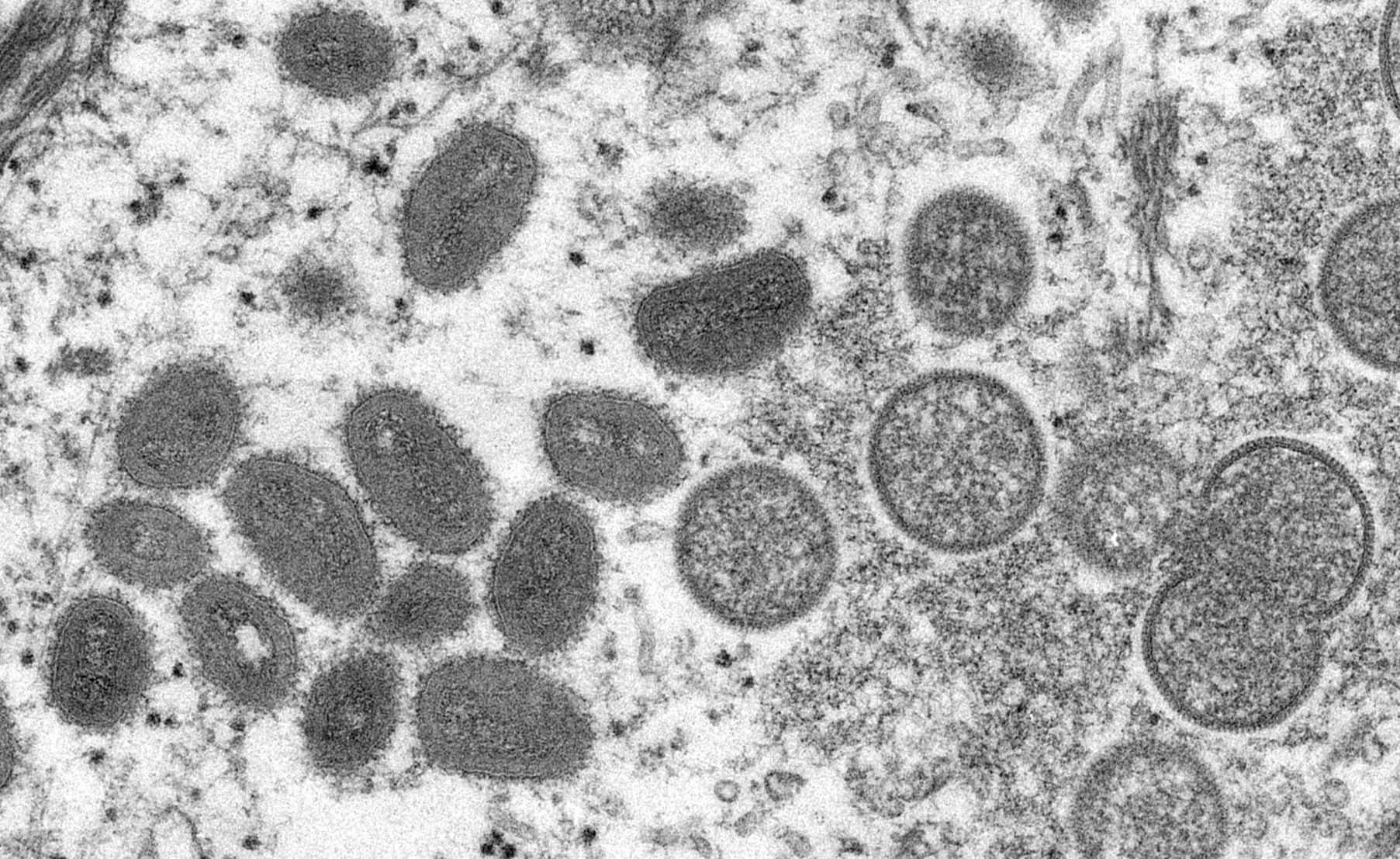 Upclose photo of the monkeypox virus.