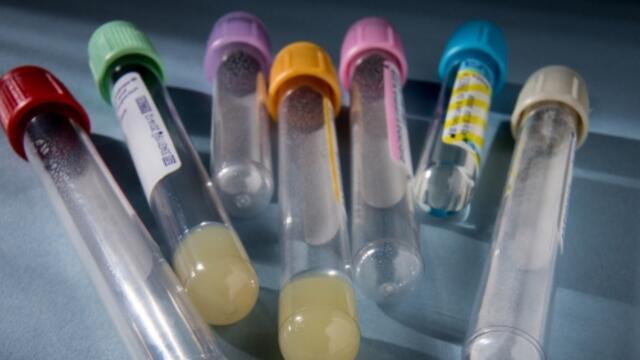 20140708_medical_008_large