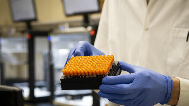 A technician holding a tray of COVID-19 testing sample vials.