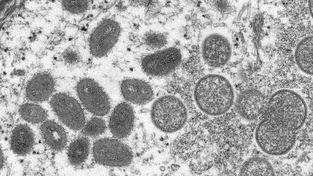 Upclose photo of the monkeypox virus.