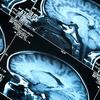 X-rays of brains.